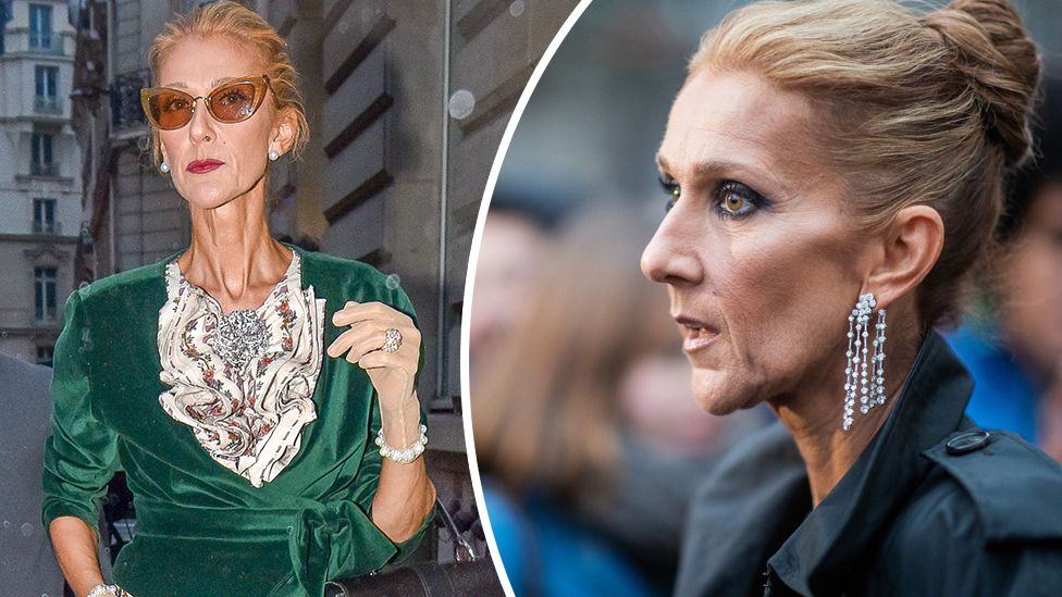 An Update On Celine Dion Health And Challenges | Linefame